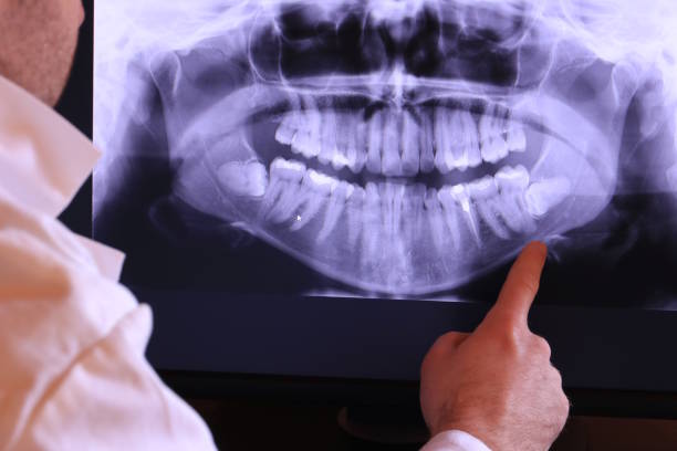 Best Emergency Denture Repair in Swedesboro, NJ